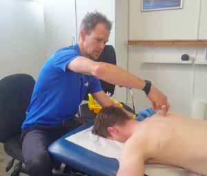 Dry Needling at APC Physio and Sports Clinic Fermoy and Cork