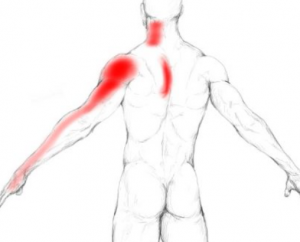 trigger points on the upper body